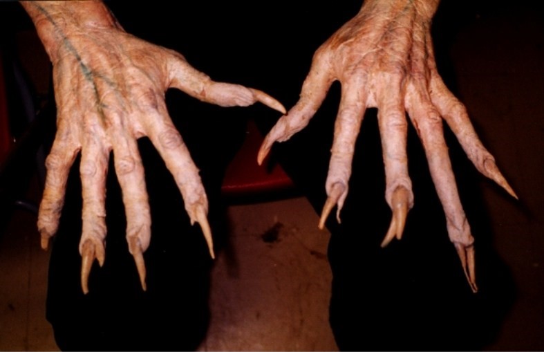 Nightmare hands
